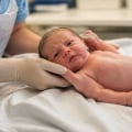 Shoulder Dystocia and Erb's Palsy: How Difficult Childbirth Can Injure Brachial Plexus Nerves and Affect Newborn Arm Movement