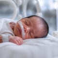 Understanding Hypoxic-Ischemic Encephalopathy (HIE) in Newborns: Causes, Symptoms, Treatment, and Legal Rights