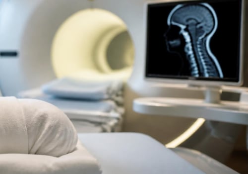 SCIWORA in Newborns: Understanding Spinal Cord Injury Without Visible Fractures, MRI Diagnosis, and Neurological Symptoms After Birth